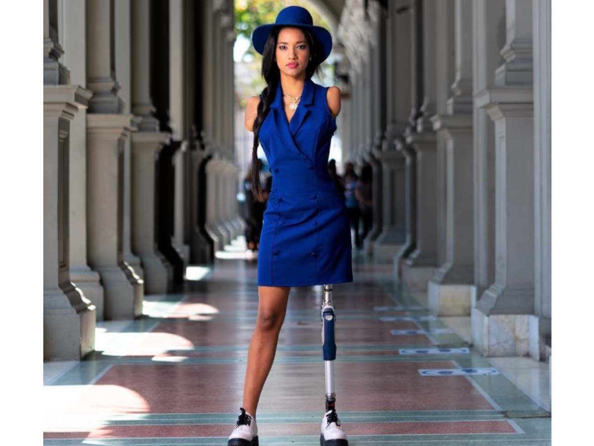 Beauty queen with no arms and a leg shares a powerful message of