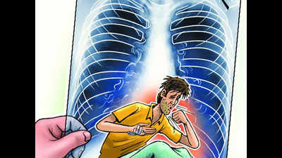 Dakshina Kannada sees rise in TB cases, Mangaluru most affected