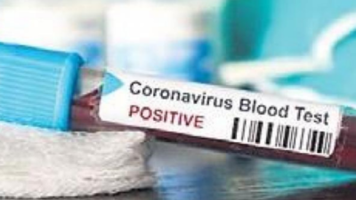 Medical student tests Covid positive in Madurai