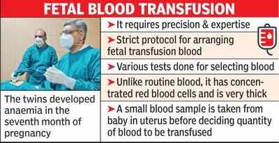 Doctors Transfuse Blood In Unborn Anaemic Twins One Survives Nagpur News Times Of India