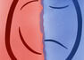 How to cope with a bipolar spouse