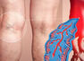 Signs of blood clot in your legs