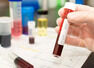 HIV+ woman fights off virus "naturally"