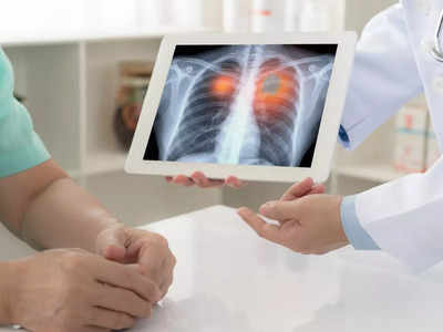 Lung damaging activities associated with cancer