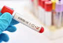 Study finds blood groups A, B and Rh+ more prone to COVID