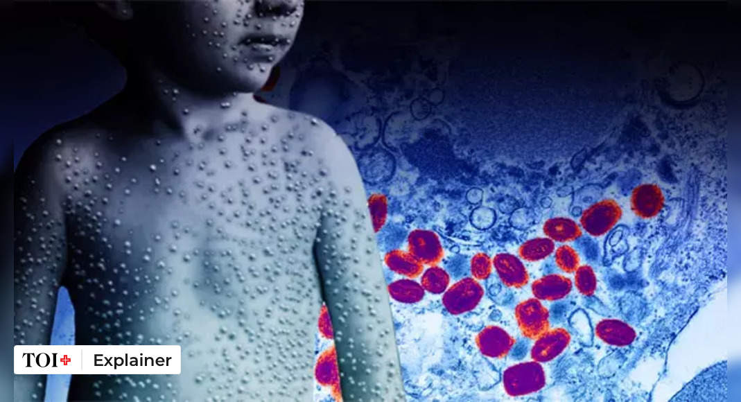 smallpox: Smallpox: Humanitys most successful fight against a virus