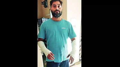 Man Held After Pet Dog Bites Neighbour | Kolkata News - Times of India