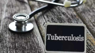 Tuberculosis co-infection worry in Omicron wave