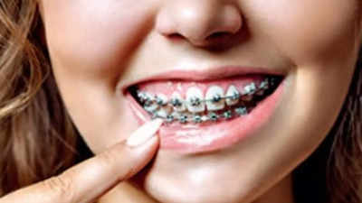 Teeth quick-fix at home a crooked business: Dentists