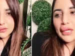 These pictures of Pakistani TikToker Hareem Shah with her incomplete lip job leave fans worried