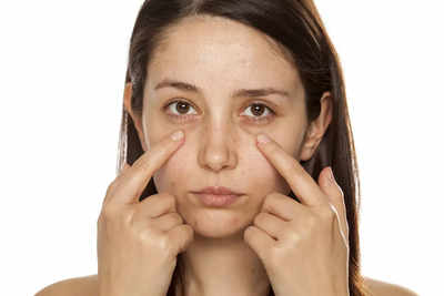 How to tackle those dark circles