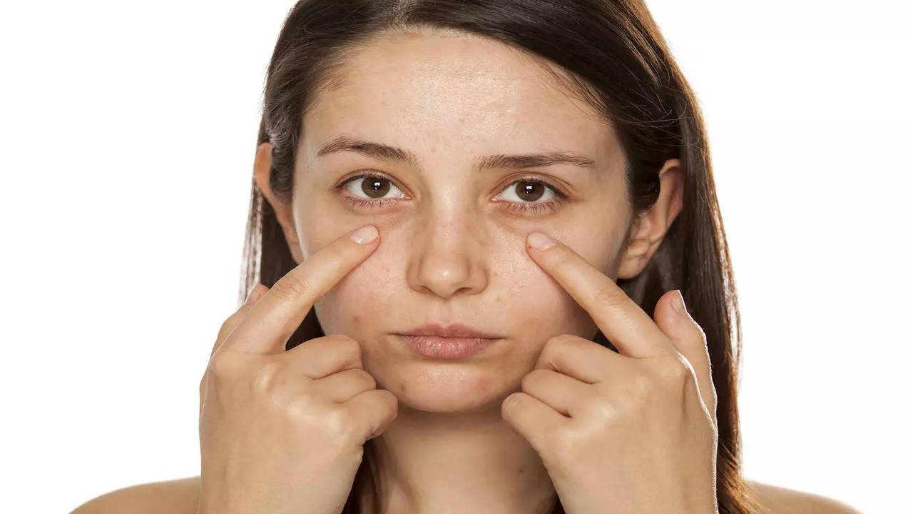 How to tackle those dark circles - Times of India