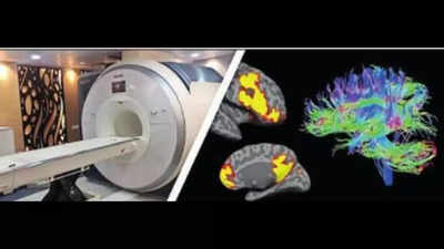 IISc team studies how brain regions affect our attention