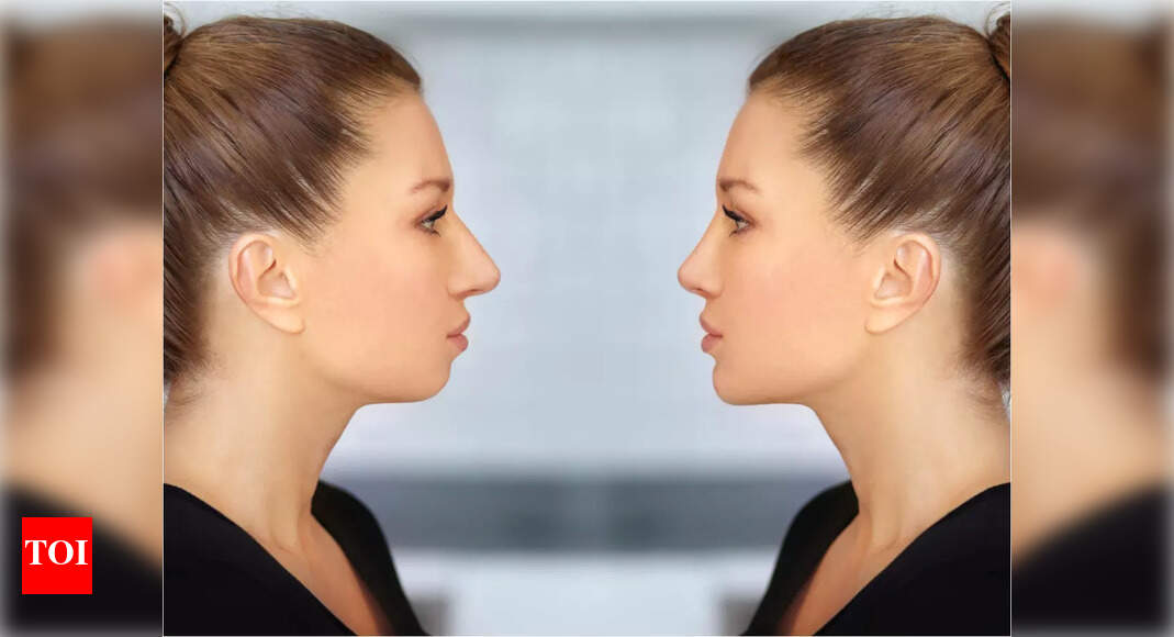 non-surgical-chin-augmentation-craze-on-a-rise-times-of-india