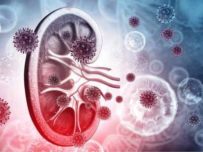 Factors that put you at risk for kidney cancer - Times of India