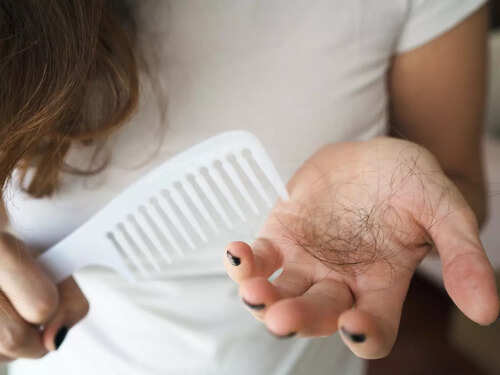 Too much hair fall? Try these asanas to get strong hair | The Times of India Too much hair fall? Try these asanas to get strong hair | The Times of India