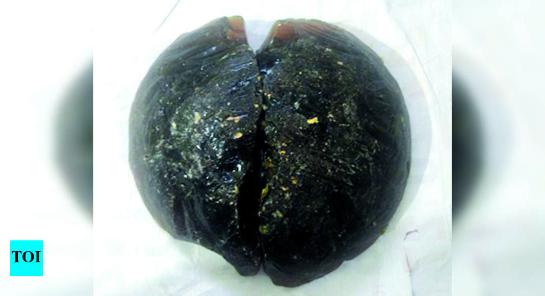 Ambergris Ambergris Worth 2.5cr Seized, 3 Held Madurai News Times
