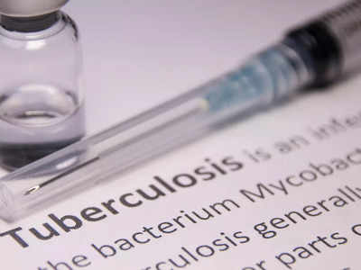 COVID-19 led to a spike in Tuberculosis cases in India: Experts
