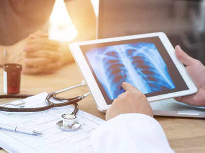 19% spike in TB cases in India during pandemic