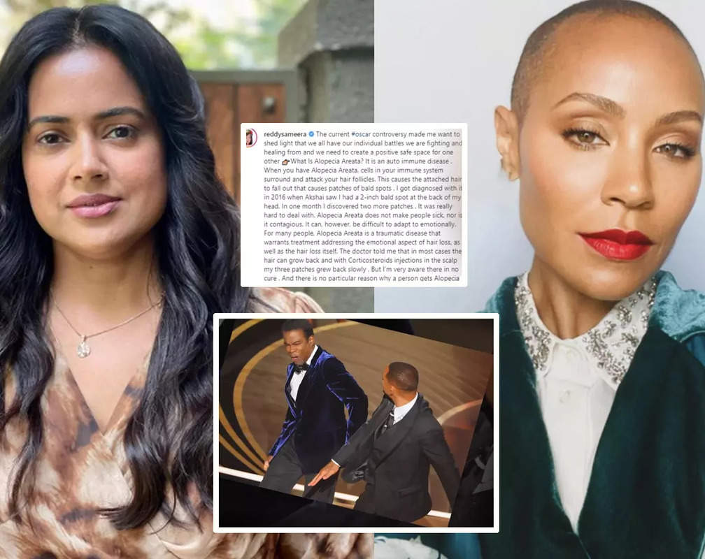 
Post Oscars slapgate incident, Sameera Reddy writes about getting diagnosed with Alopecia disease which Will Smith's wife Jada Pinkett Smith’s is suffering from
