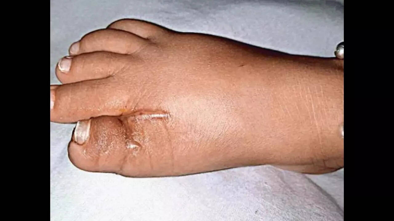 Discover 131+ hammer and nail bangalore ceg.edu.vn