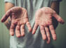 Why is Monkeypox called Monkeypox; cases on rise