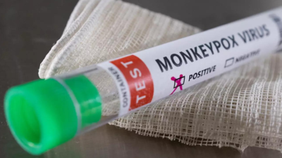 Risk of monkeypox spreading widely 'very low': EU agency