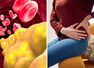 High cholesterol: Watch out for pain in these 3 areas