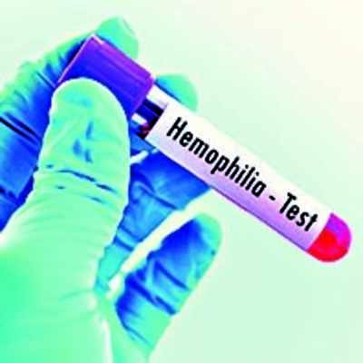 Haemophilia: Facility For Early Haemophilia Diagnosis | Kochi News ...