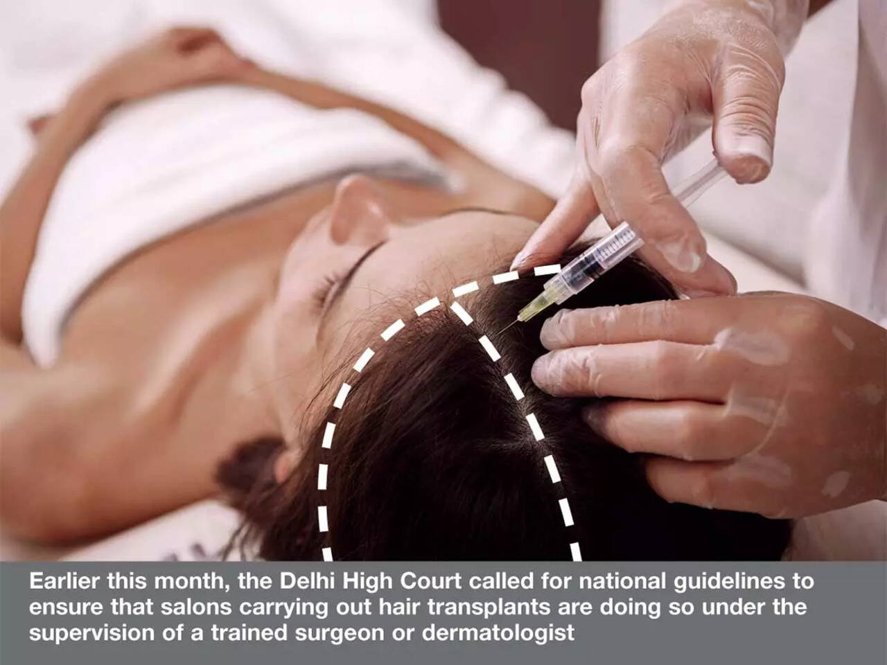 Best Hair Transplant In India Who Should Perform Hair Transplant  Venkat  Center