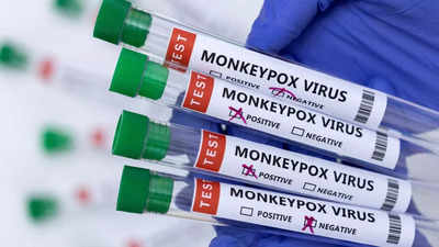 Over 200 cases of monkeypox worldwide: Key points