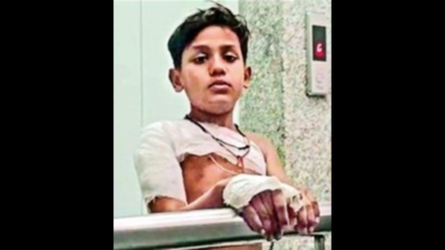Jaipur: Nine-year-old boy hospitalised after being attacked by dogs