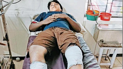 Kerala: Teenager sustains serious injuries in wild boar attack in Thiruvambady