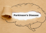 Feet problems that can indicate Parkinson's disease