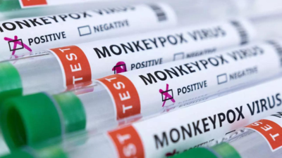 UK health authorities issue updated guidance as monkeypox cases rise
