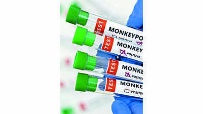 Monkeypox screening begins in dists, no case found so far
