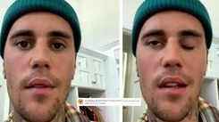 Justin Bieber diagnosed with rare disorder Ramsay Hunt Syndrome that has caused half of his face paralysed