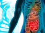 Bowel cancer: THIS common sign can be an indicator