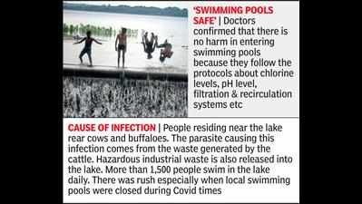 Nagpur: Rare infection seen among Ambazari lake swimmers