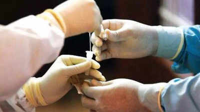 72 more Covid positive in Lucknow, positivity rate rises