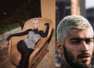 Celebs who revealed their anxiety disorders