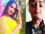 Pictures of Kannada actress Swathi Sathish go viral after her root canal surgery goes wrong