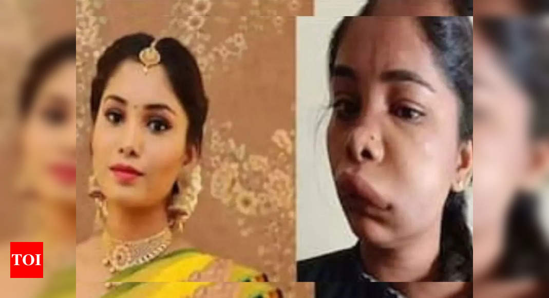 Kannada actor Swathi Sathish ends up with swollen face after root canal procedure; know what it is and possible reasons why it went wrong – Times of India