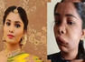 Swathi Sathish left with swollen face after root canal