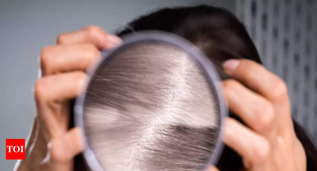 Hair fall problems? It's time you shouldn't ignore those - Times of India