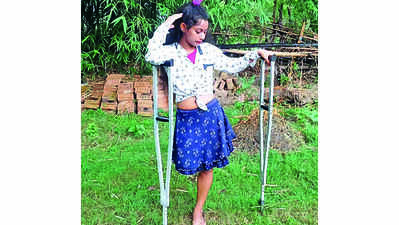 A Leg Lost In Accident, Gritty Girl Lives Her Dream As A Dancer ...