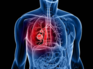 Know how COVID damages your lungs
