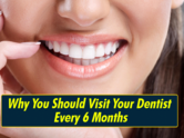 Why you should visit your dentist every 6 months