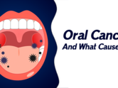 Oral Cancer And What Causes It