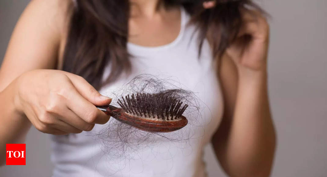 The bald truth: why you are losing hair and how to prevent it | India News  - Times of India